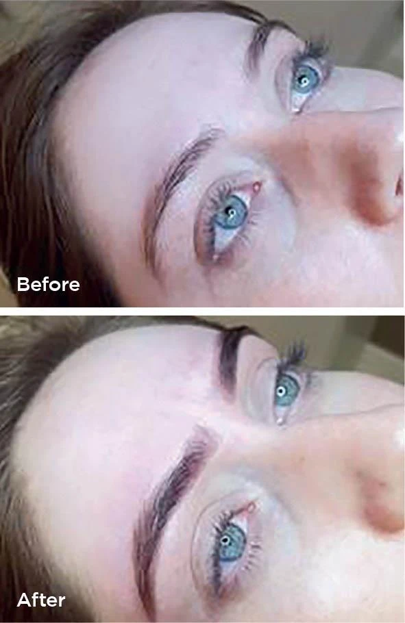 HD Brows before and after at Beauty Studio MediSpa, Shenfield
