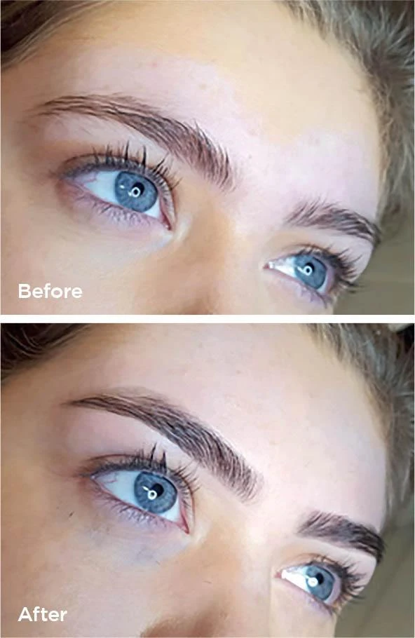 HD Brows before and after at Beauty Studio MediSpa, Shenfield