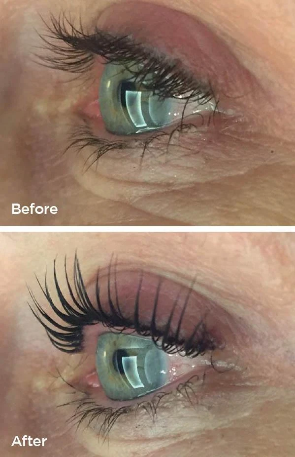 LVL lash lift before and after at Beauty Studio MediSpa, Shenfield