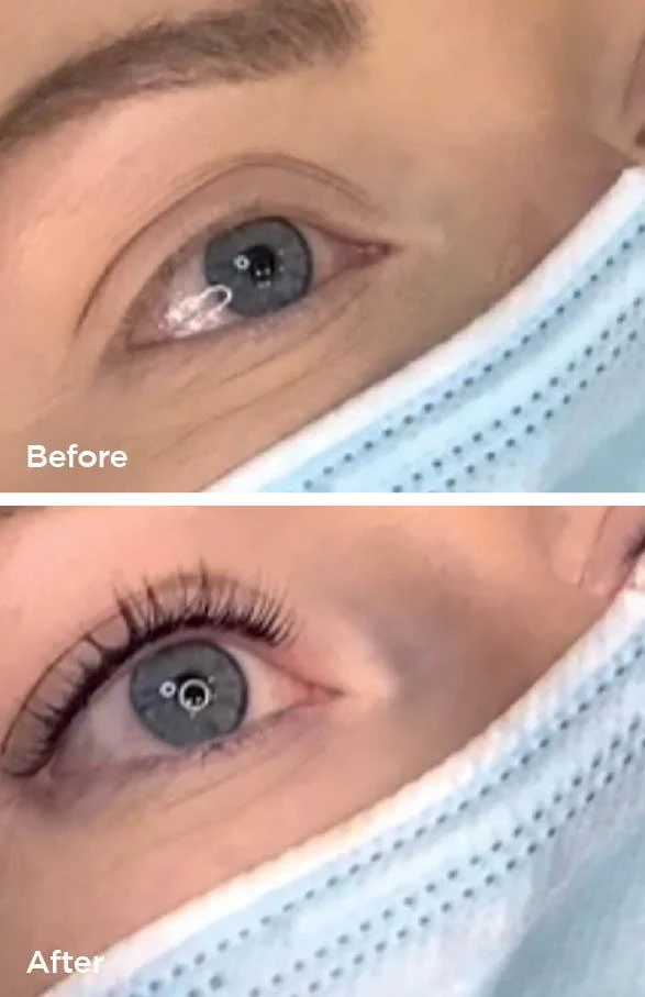 LVL lash lift before and after at Beauty Studio MediSpa, Shenfield