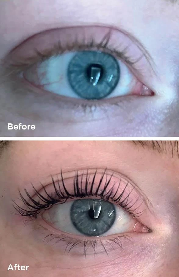 Lash lift and brow tint before and after at Beauty Studio MediSpa, Shenfield
