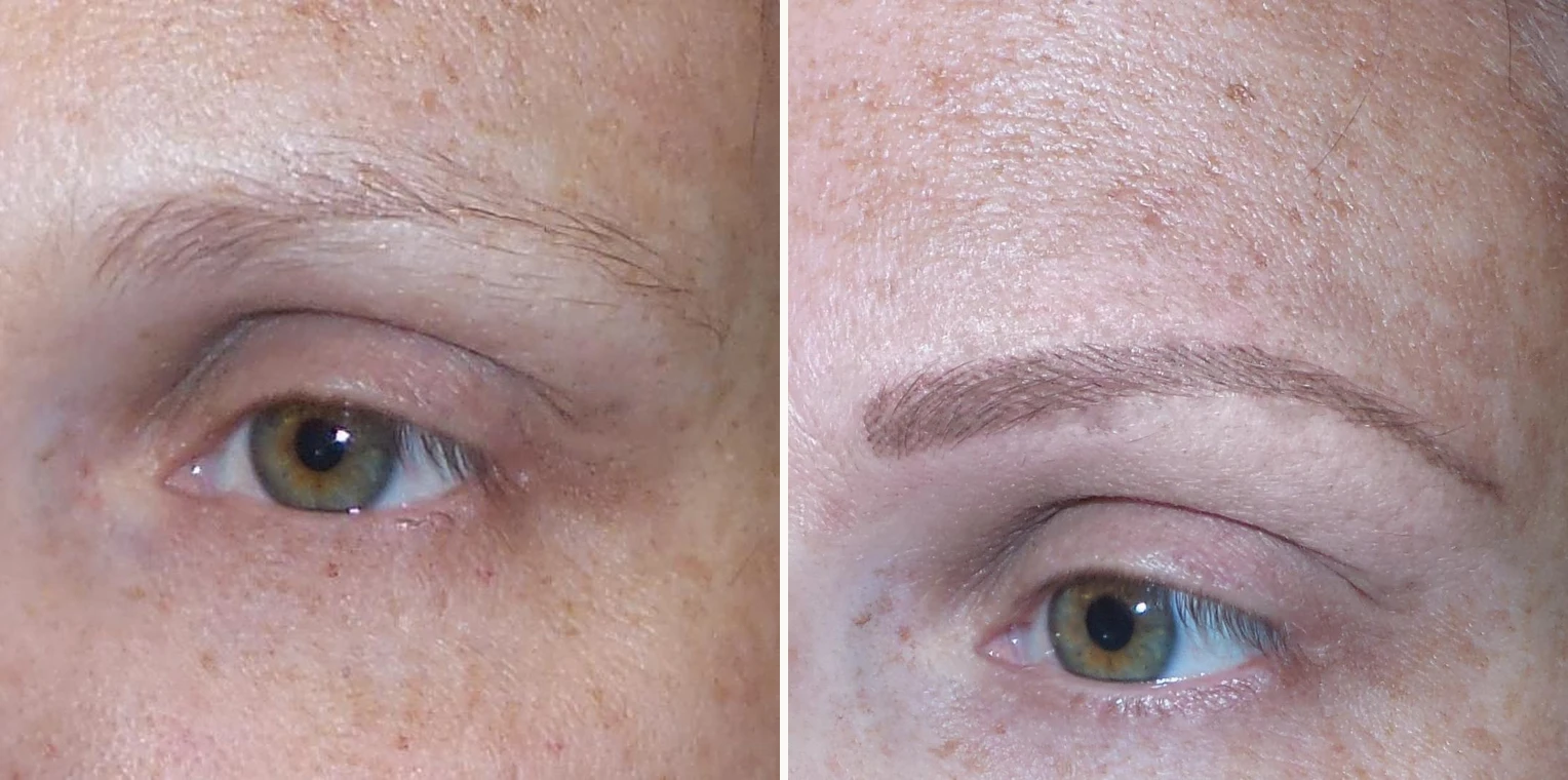 Permanent make up brows before and after by Sandy Hamber at Beauty Studio MediSpa, Shenfield