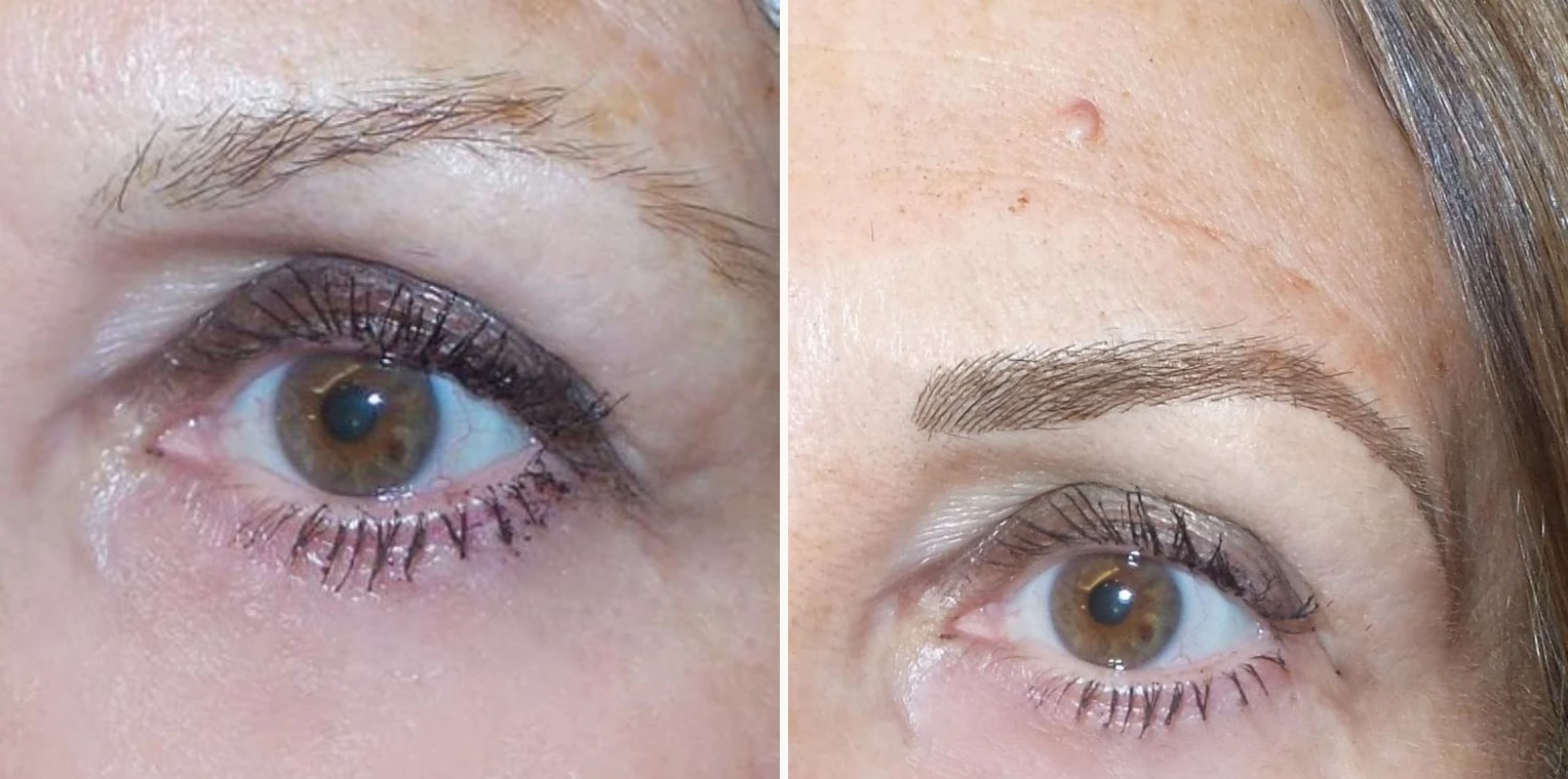 Permanent make up brows before and after by Sandy Hamber at Beauty Studio MediSpa, Shenfield