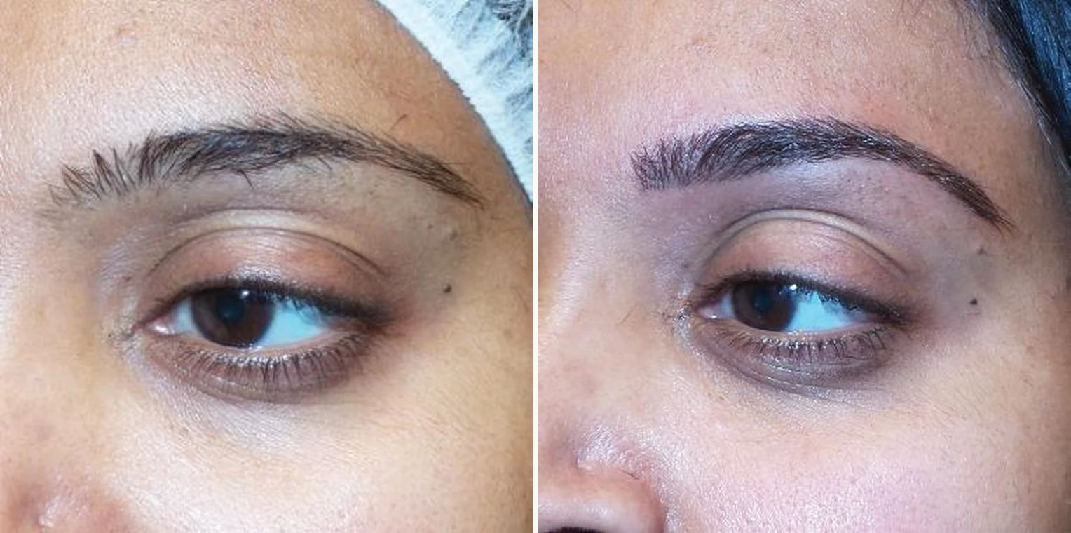 Permanent make up brows before and after by Sandy Hamber at Beauty Studio MediSpa, Shenfield