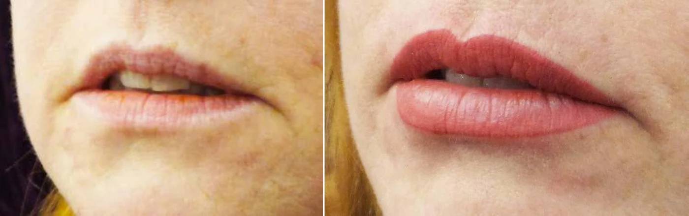 Permanent make-up lip blush before and after at Beauty Studio MediSpa, Shenfield