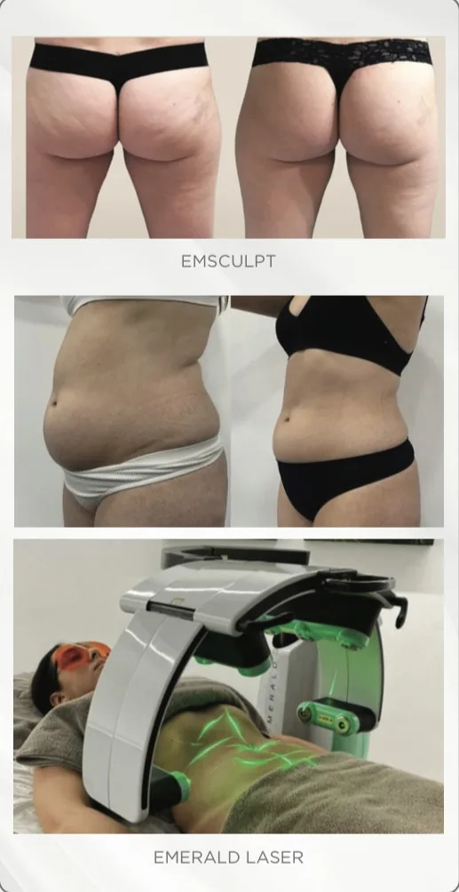 Body transformation results