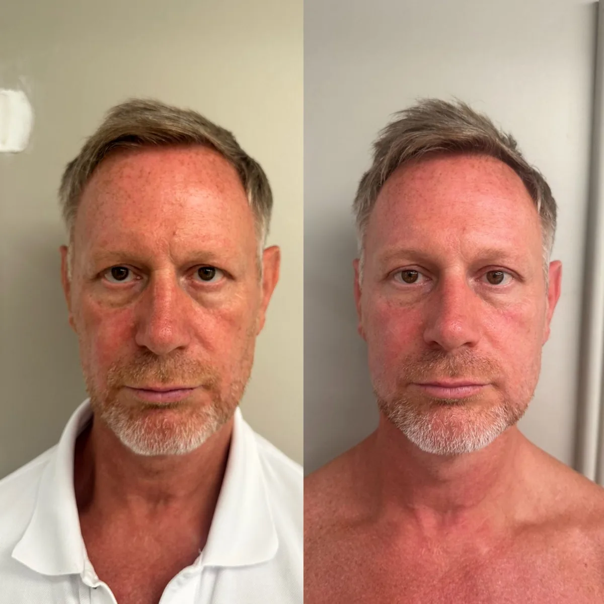 Men – it’s your time to shine