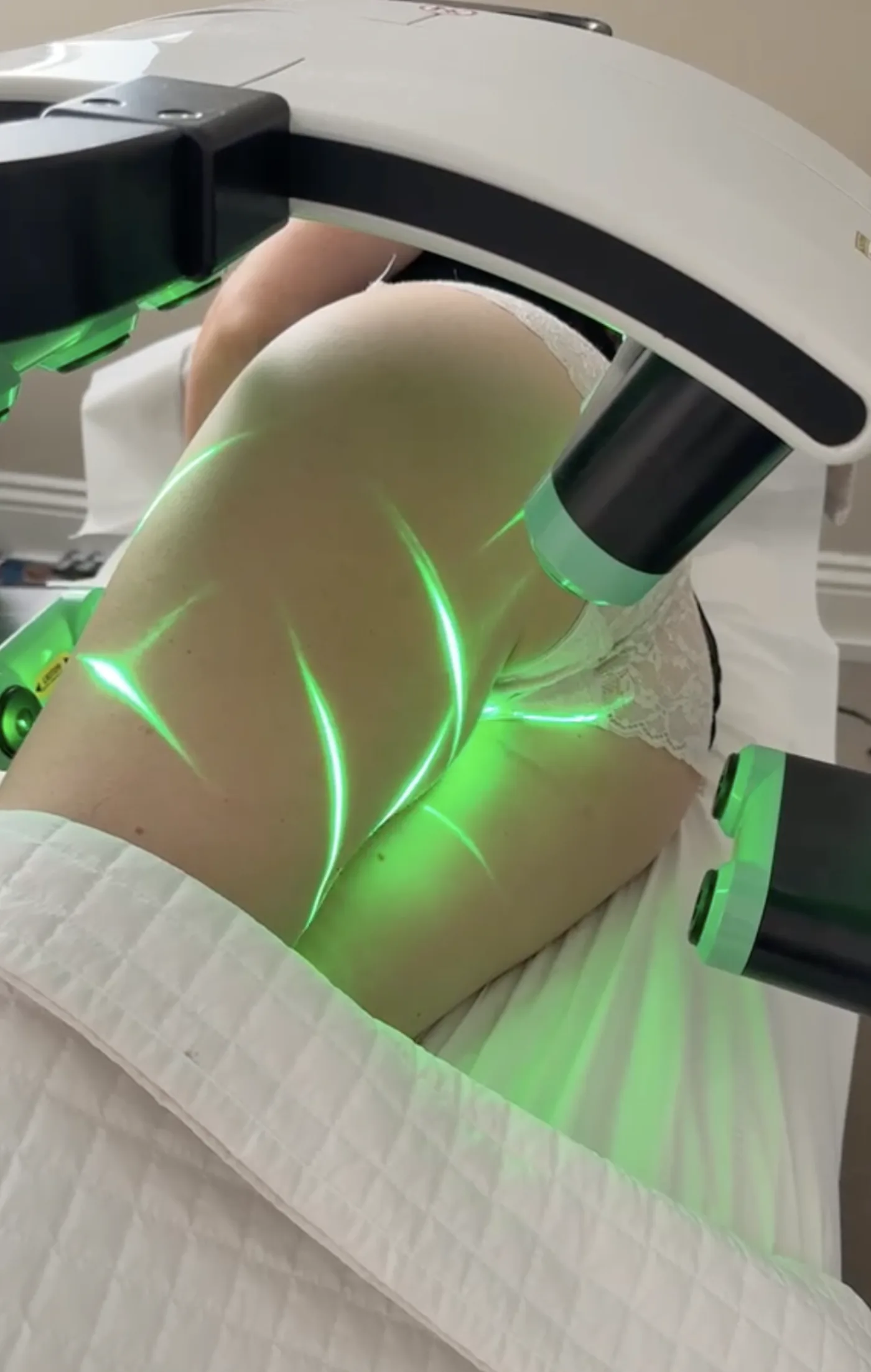 Is Emerald Laser right for you, Beauty Studio MediSpa, Shenfield