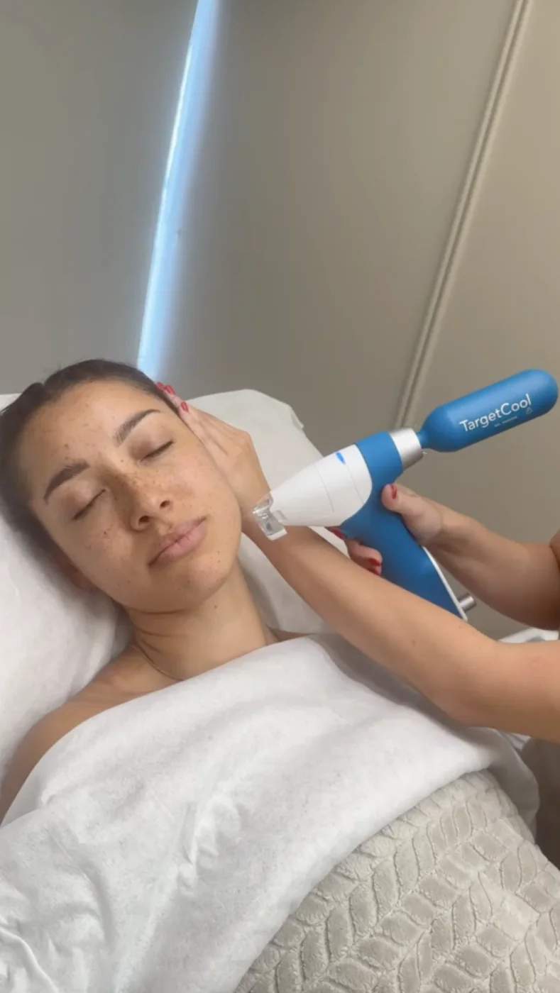 E50 Exosomes TargetCool treatment at Beauty Studio MediSpa, Shenfield