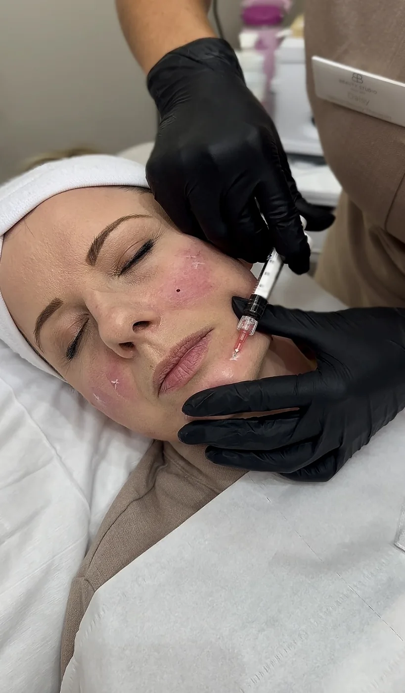 Injectable aesthetics treatment at Beauty Studio MediSpa, Shenfield