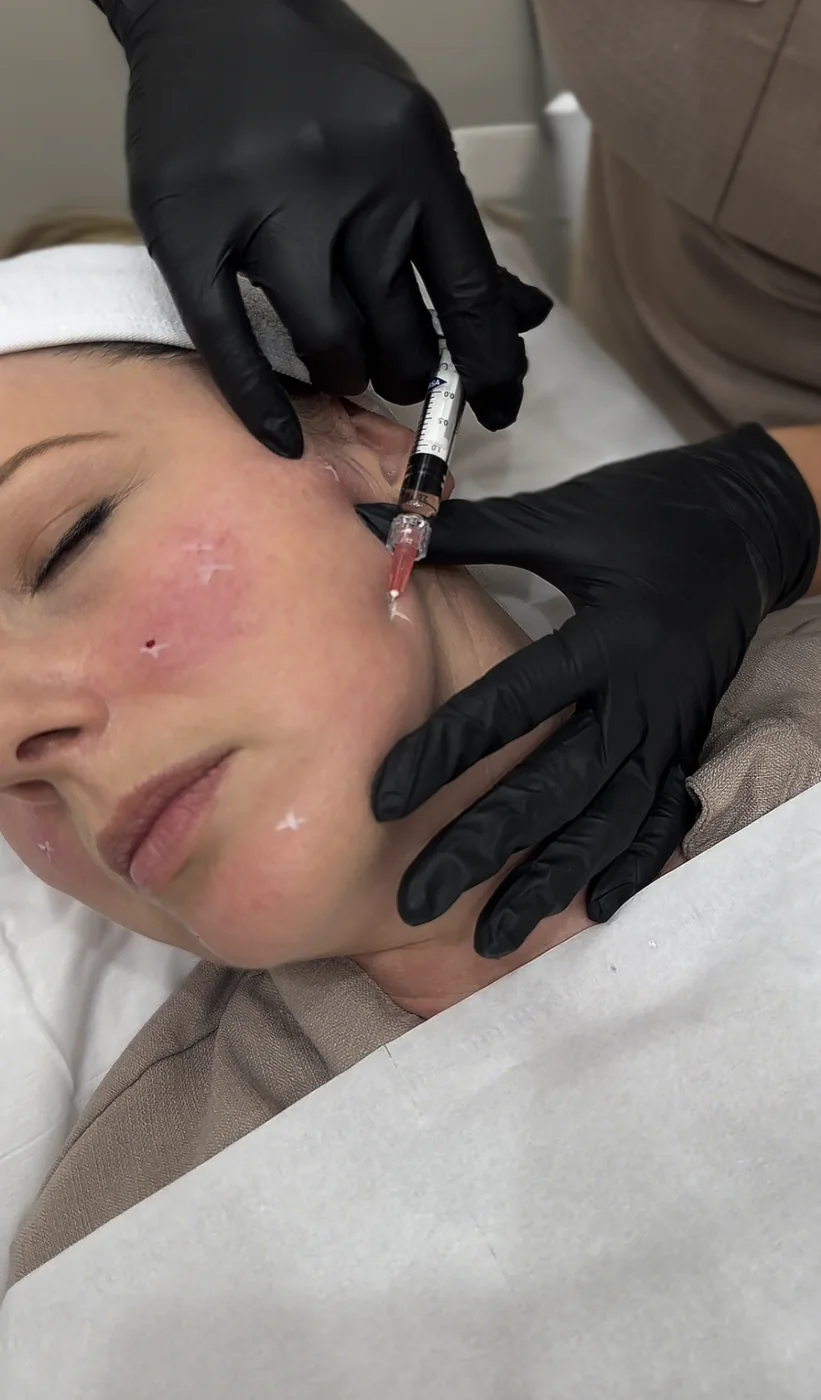 Injectable aesthetics treatment at Beauty Studio MediSpa, Shenfield