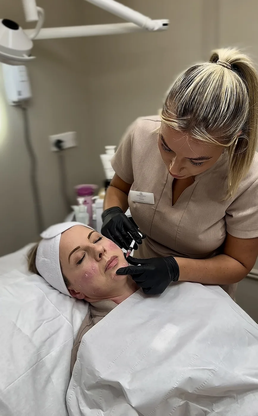 Dermal filler lip treatment at Beauty Studio MediSpa, Shenfield