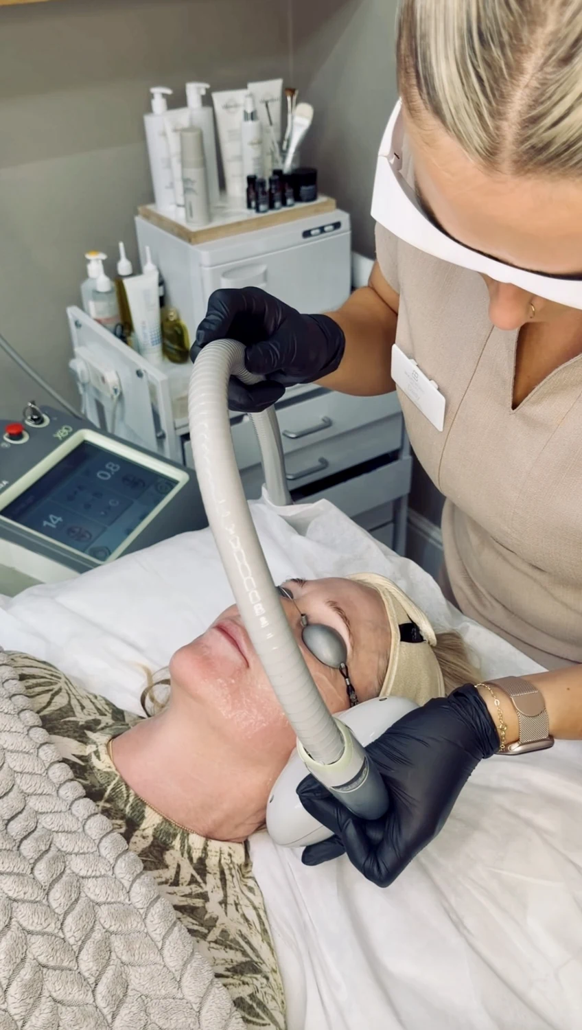 Is Limelight IPL for Age Spots & Veins right for you, Beauty Studio MediSpa, Shenfield