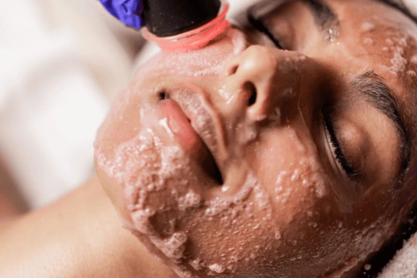 GeneO+ Super Facial at Beauty Studio MediSpa, Shenfield