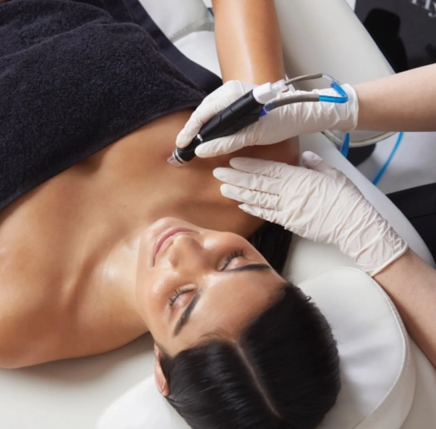 HydraFacial for the Body at Beauty Studio MediSpa, Shenfield