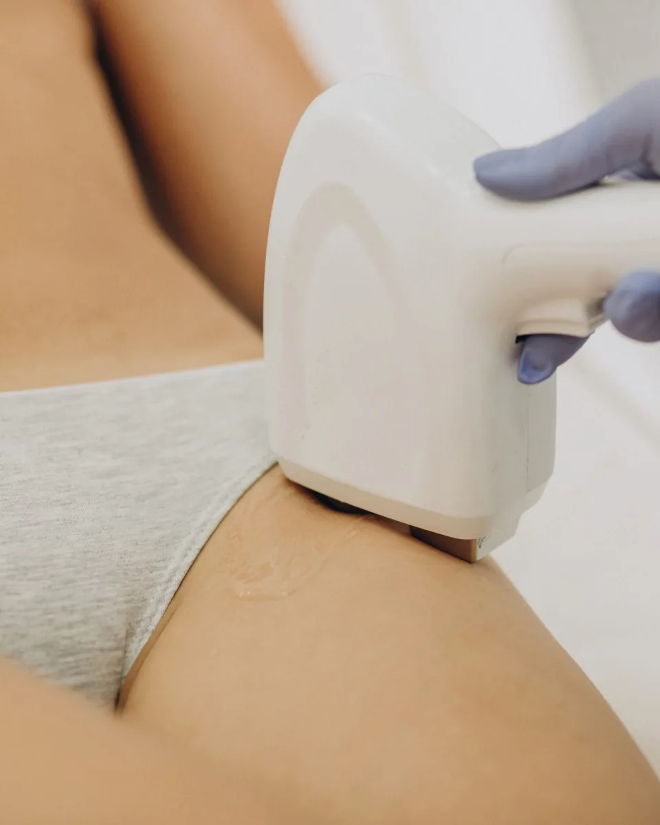 Brazilian Laser Hair Removal at Beauty Studio MediSpa, Shenfield