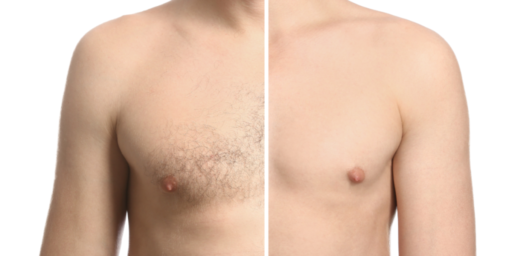 Upper body before and after