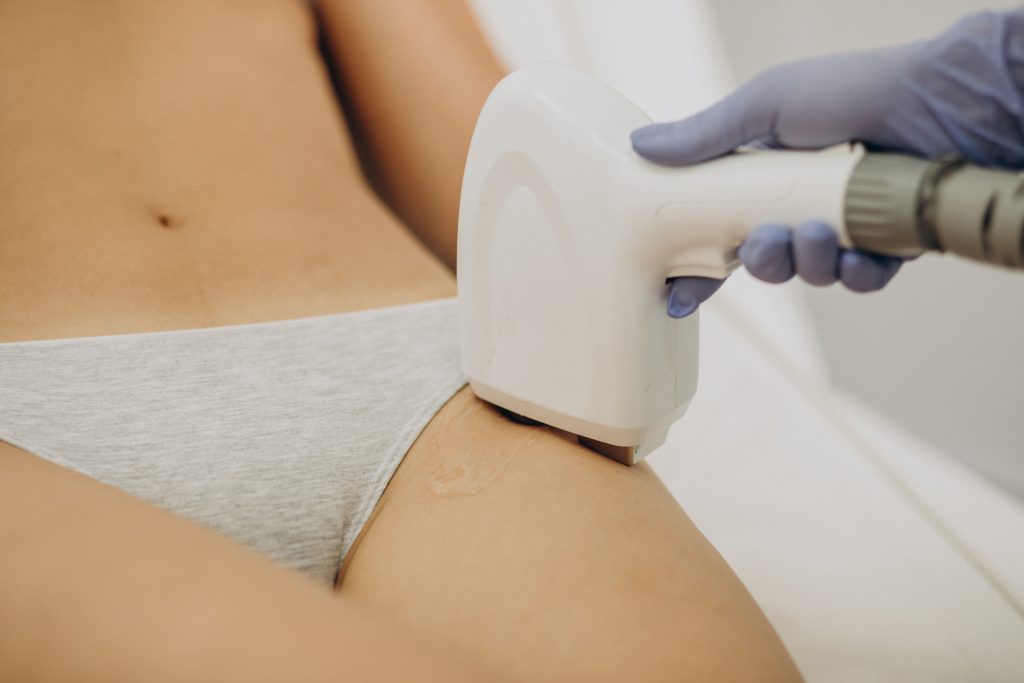 Brazilian laser hair removal treatment