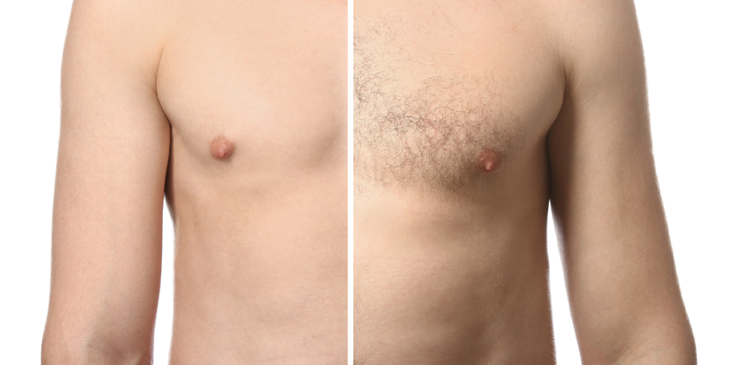 men before after