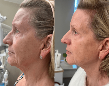 emface add people (2) 1