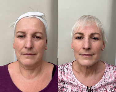 emface add people (2) 2